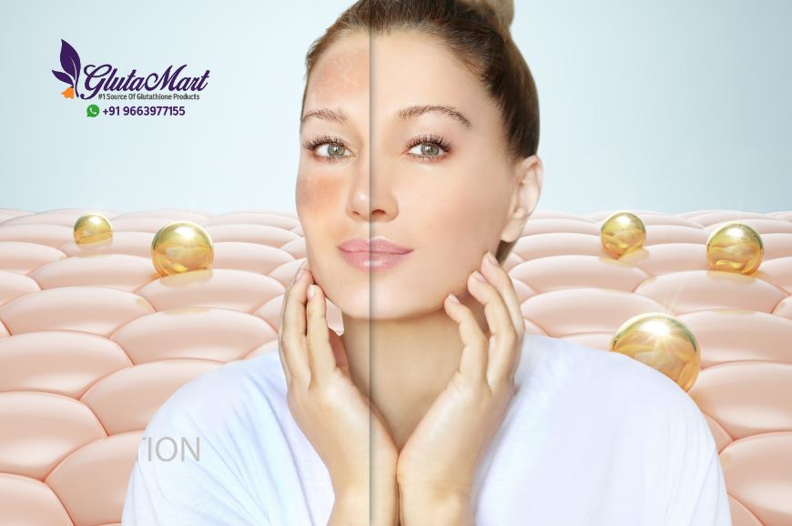 Cost of Skin Whitening Cream: What You Need to Know Before Buying